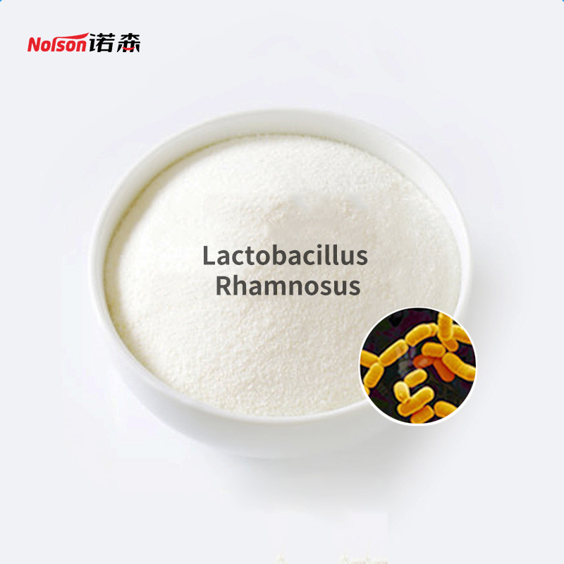 工廠供應 鼠李糖乳桿菌 100億CFU/g 凍干粉 可定制 青島諾森生物  益生菌固體飲料原料 